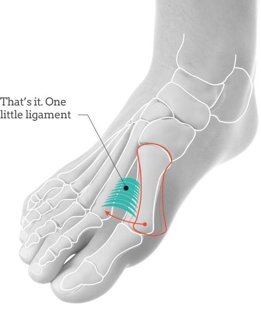Bunions Purpose Problems not to mention Treatment options