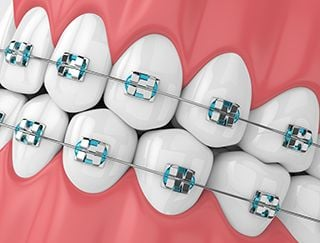The significance involving Dental Maintain proper Lifestyle